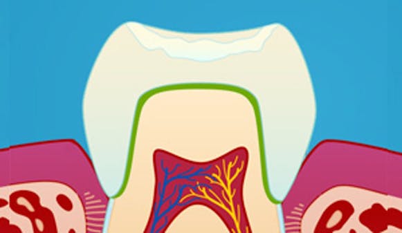 Estetisk_kroneterapi_w300-1__ade79791554be6670df8601de675f0fa