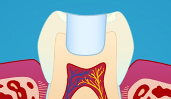 Fyllingsterapi__w300__f9f8ea6f8e00a948b18f74624b8d6db4