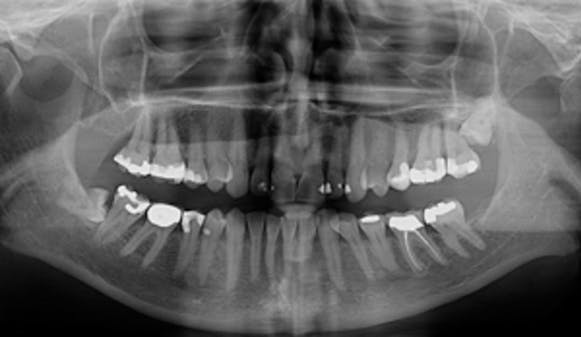 Sykdom_thumb_w300__c0d71250e089107665fe6da8439ec0cb