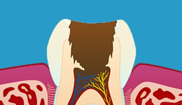 betennelse_i_nerven-_w300__fe0eaa3f3cec2c20afa5ea76355697fb